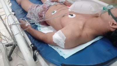 Pulang Kerja Dini Hari, Karyawan Pabrik Diduga Ditusuk Geng Motor di Batam Kota     